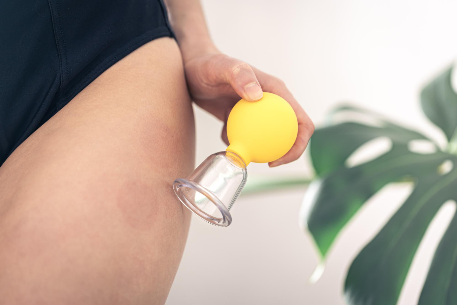 Vacuum terapia a Torino